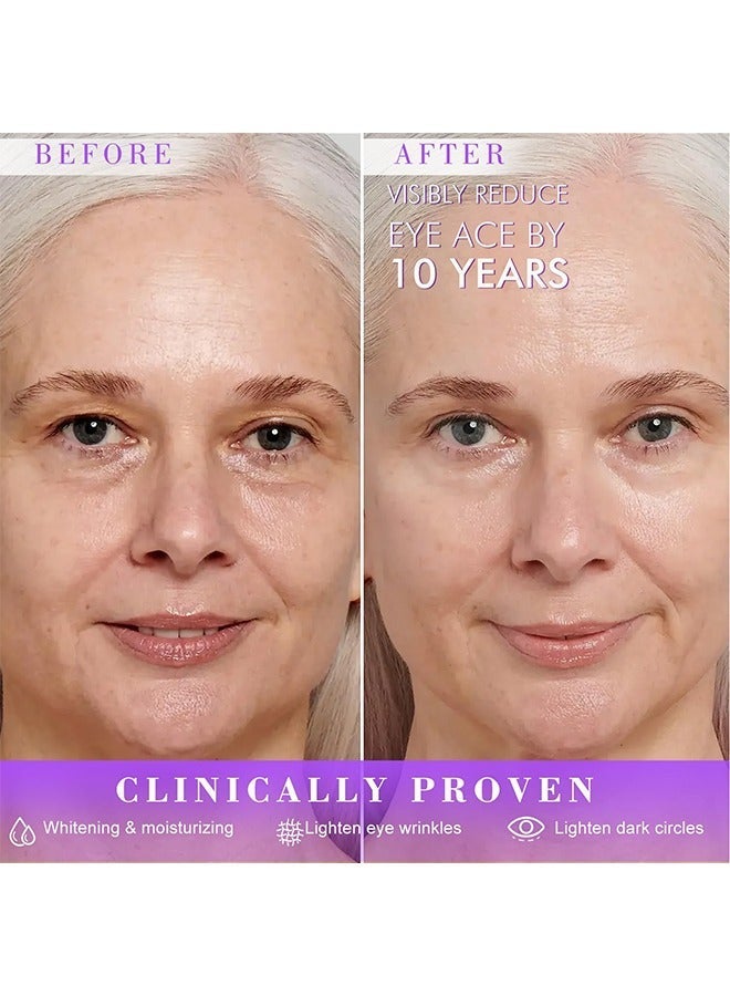 ك أو إي سي كريم العين بالريتینول لشد وتغذية البشرة، كريم مرطب ومانح للشد ومضاد للتجاعيد حول العينين للهالات السوداء والانتفاخ 20 مل - Image 4